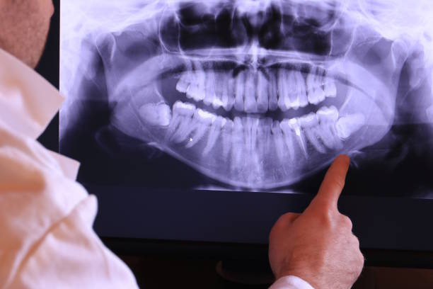 Best Orthodontic Emergency Dentist in Chino Hills, CA